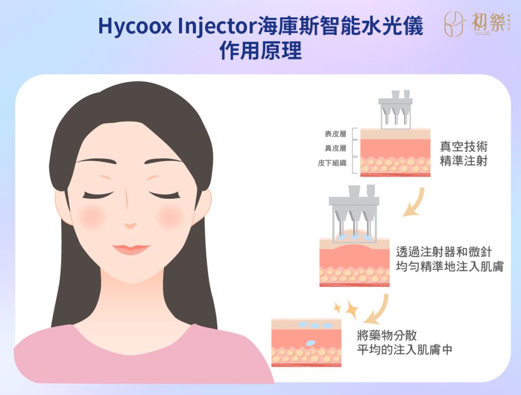 Hycoox Injector海庫斯智能"水光槍"作用原理圖解