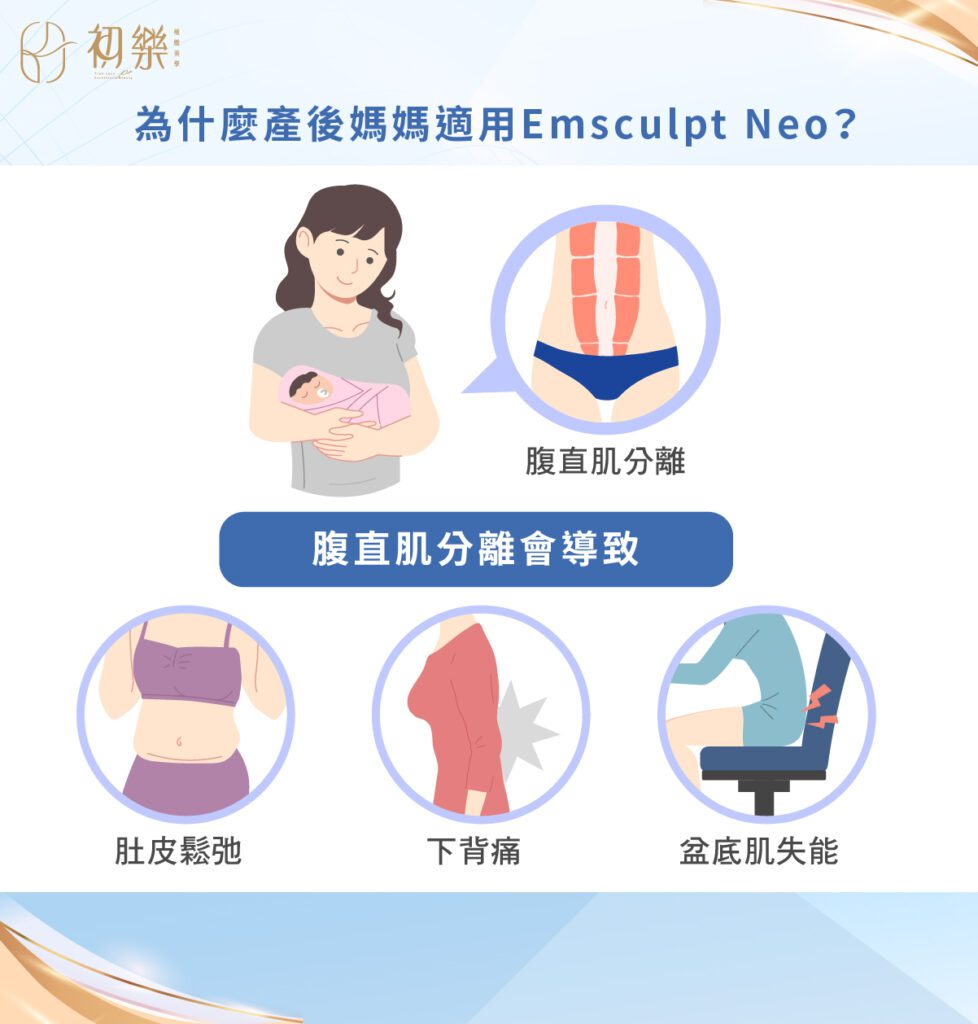 產後媽媽使用熱磁減脂Emsculpt Neo"增肌減脂效果"?