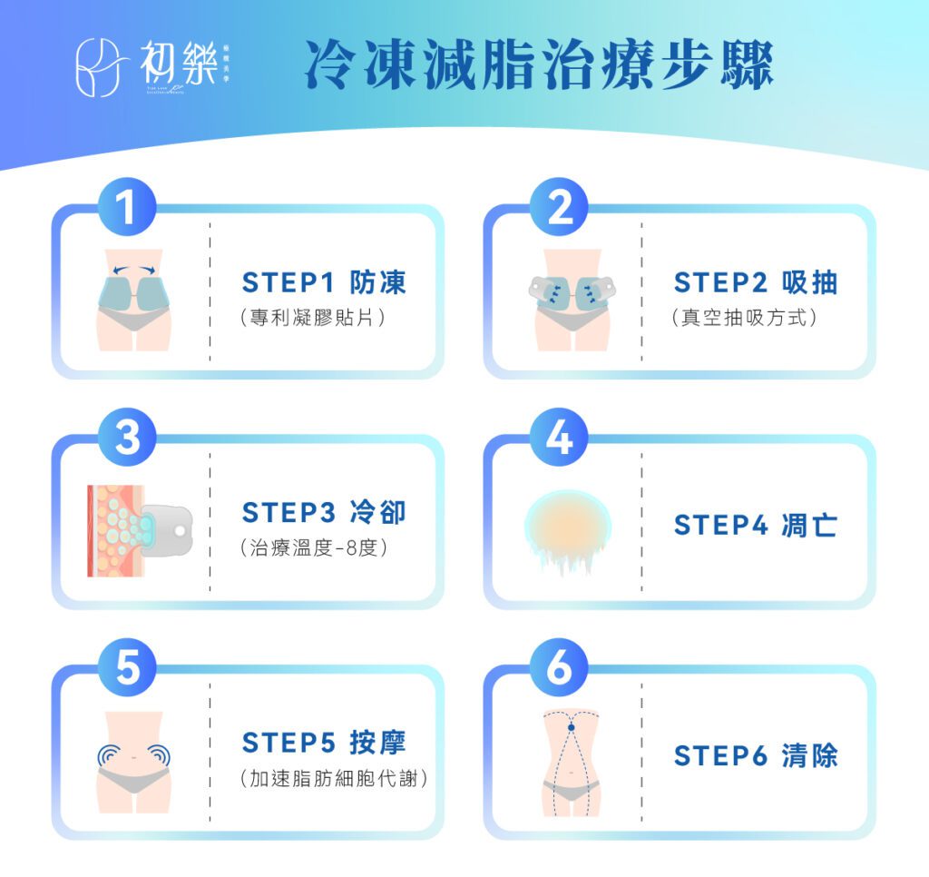 冷凍減脂治療效果及步驟